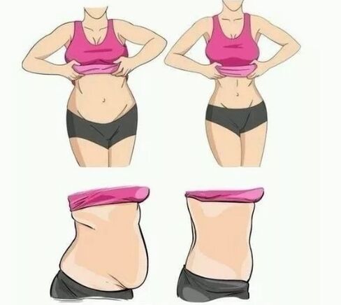 Loss of weight belly